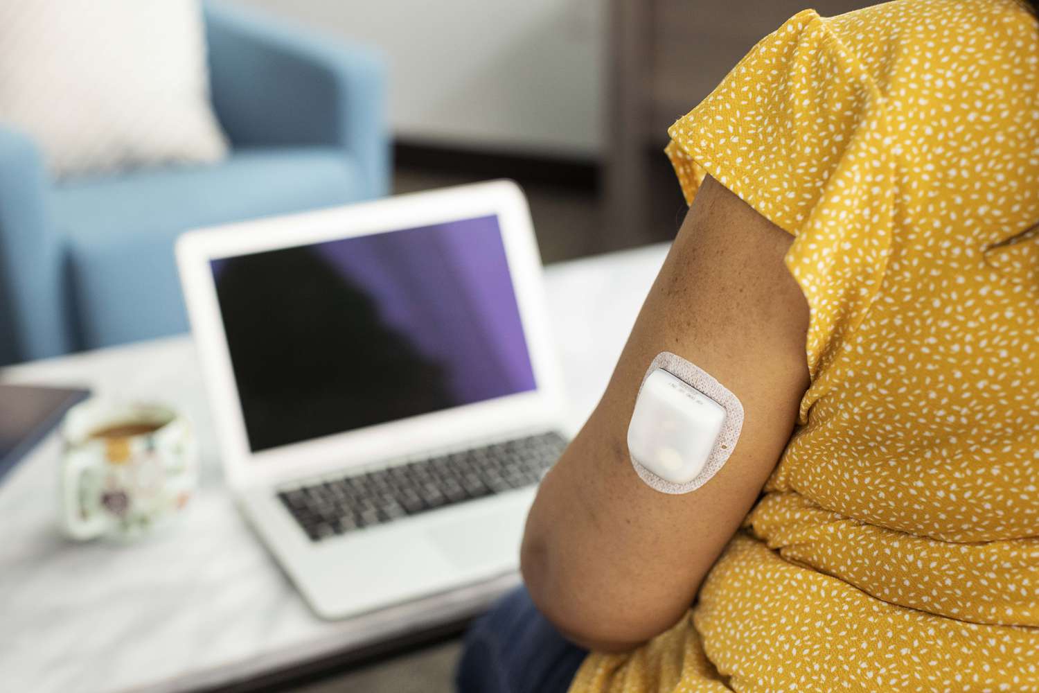 Insulet Omnipod DASH on Arm